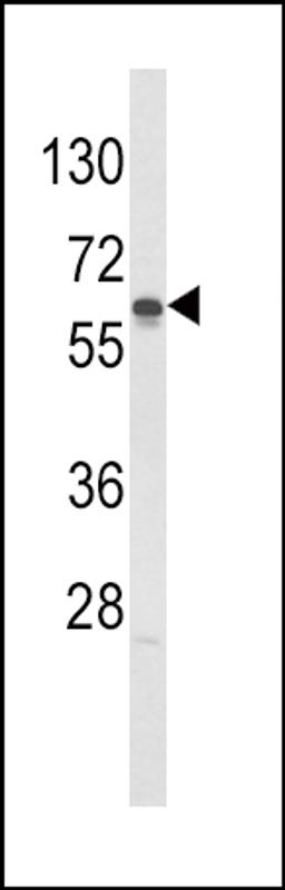 Western blot analysis of hGCK-S418 in Jurkat cell line lysates (35ug/lane)