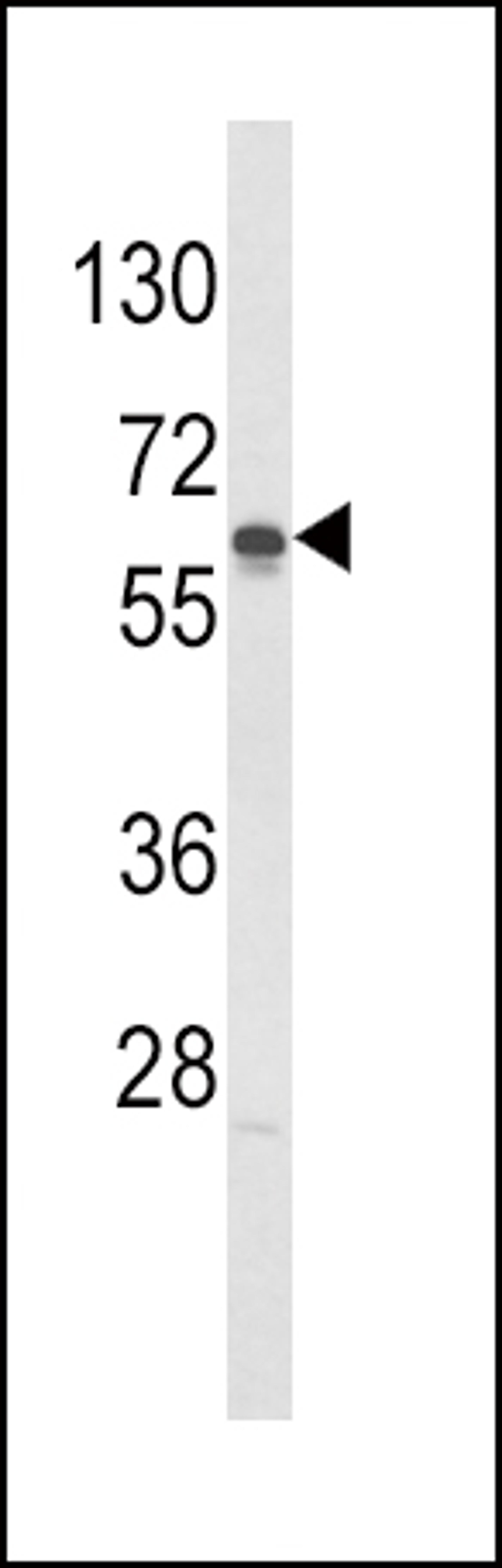 Western blot analysis of hGCK-S418 in Jurkat cell line lysates (35ug/lane)