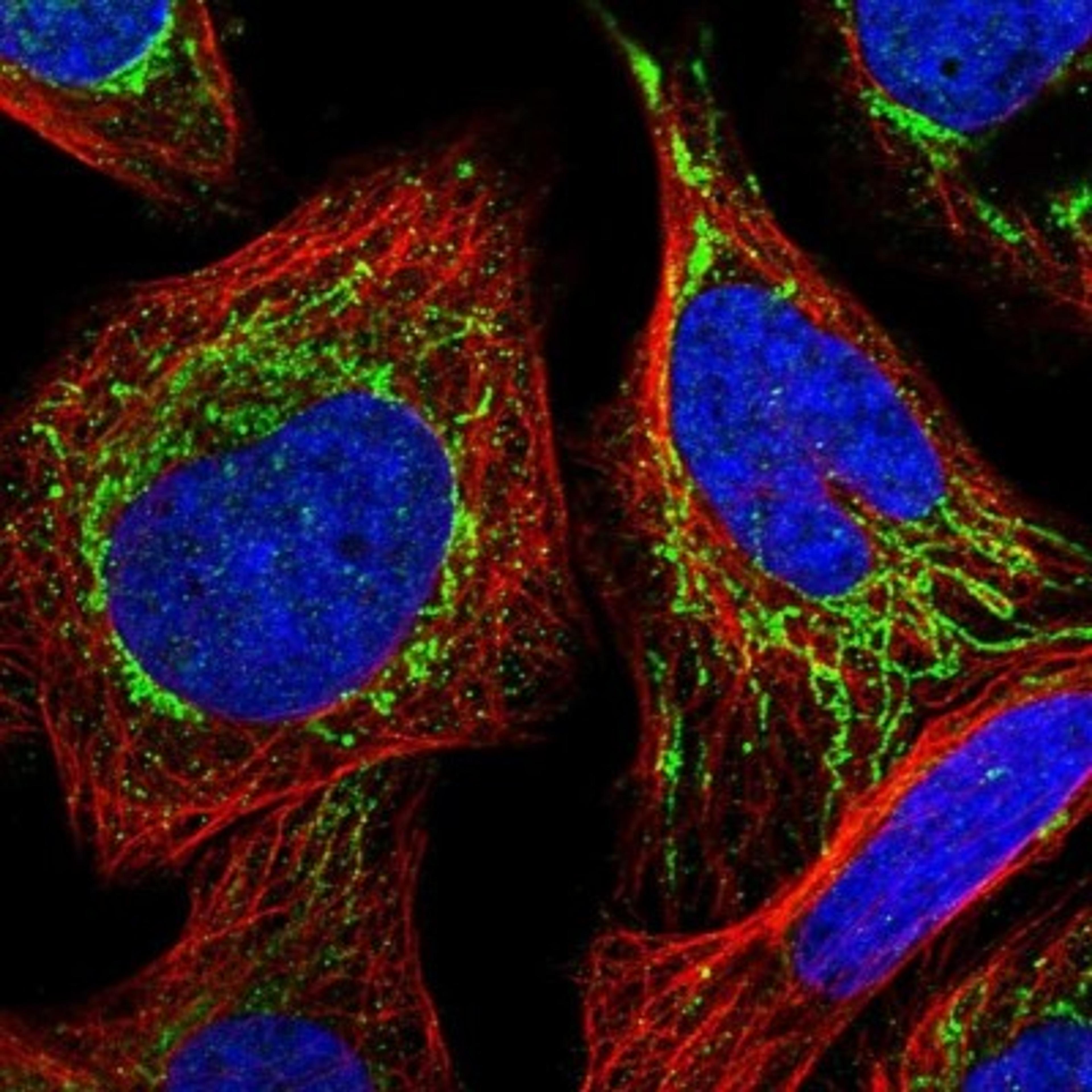 Immunocytochemistry/Immunofluorescence: METTL4 Antibody [NBP1-82095] - Staining of human cell line U-2 OS shows positivity in mitochondria.