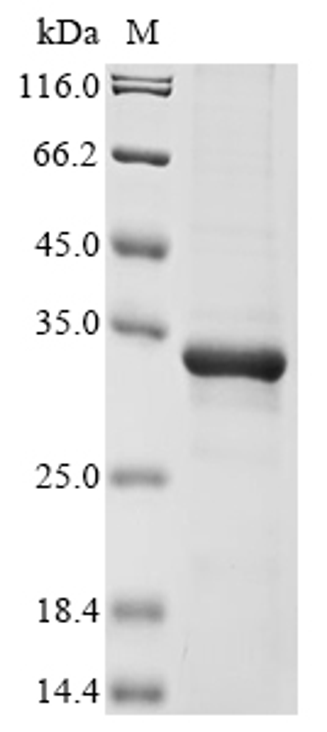 (Tris-Glycine gel) Discontinuous SDS-PAGE (reduced) with 5% enrichment gel and 15% separation gel.
