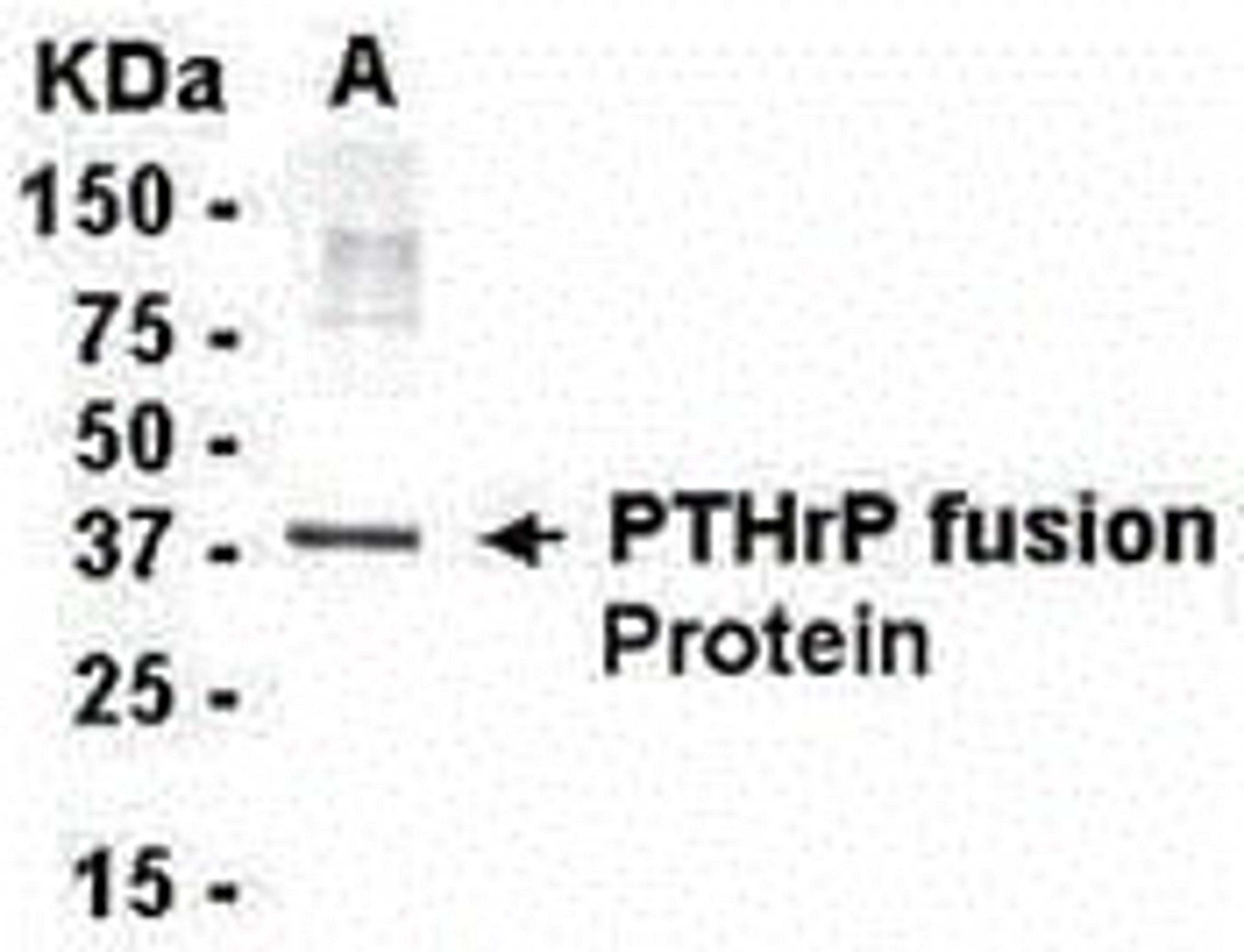 E coli-derived fusion protein as test antigen. Affinity-Purified IgY dilution: 1:2000, Goat anti-IgY-HRP dilution: 1:1000. Colorimetric method for signal development.