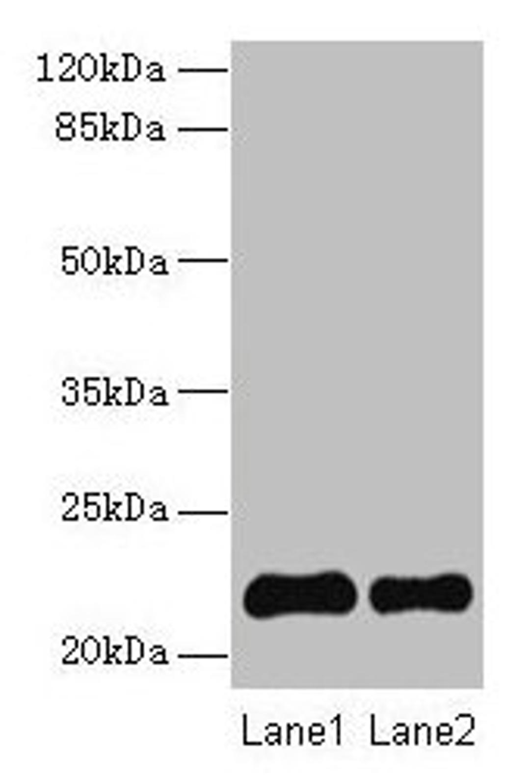 Western blot. All lanes: SIRPD antibody at 14µg/ml. Lane 1: 293T whole cell lysate. Lane 2: Mouse spleen tissue. Secondary. Goat polyclonal to rabbit IgG at 1/10000 dilution. Predicted band size: 22 kDa. Observed band size: 22 kDa