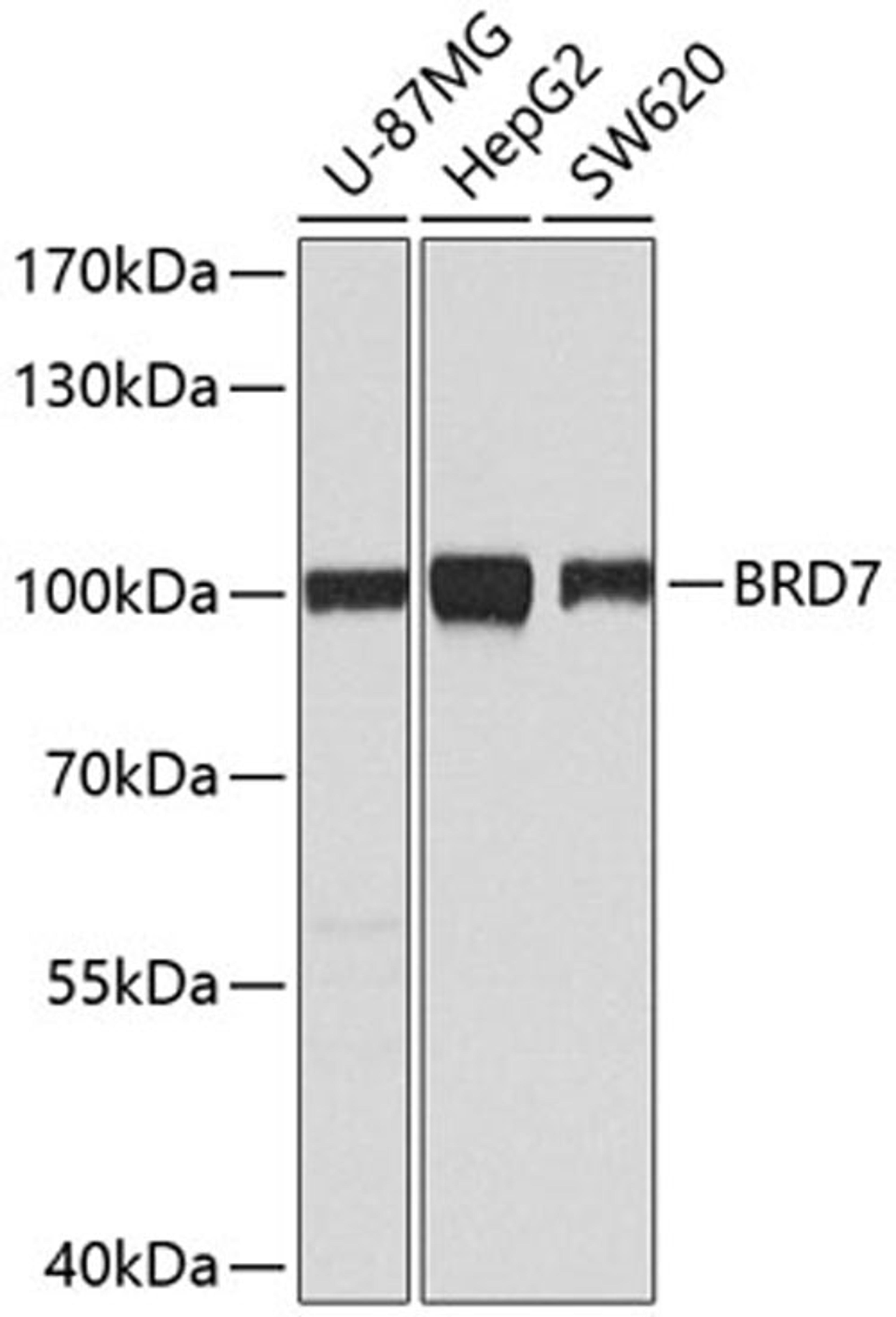 Western blot - BRD7 antibody (A2308)