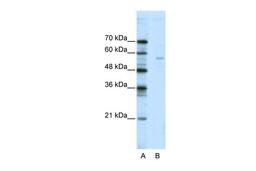 Antibody used in WB on Human Jurkat cells at 2.5 ug/ml.