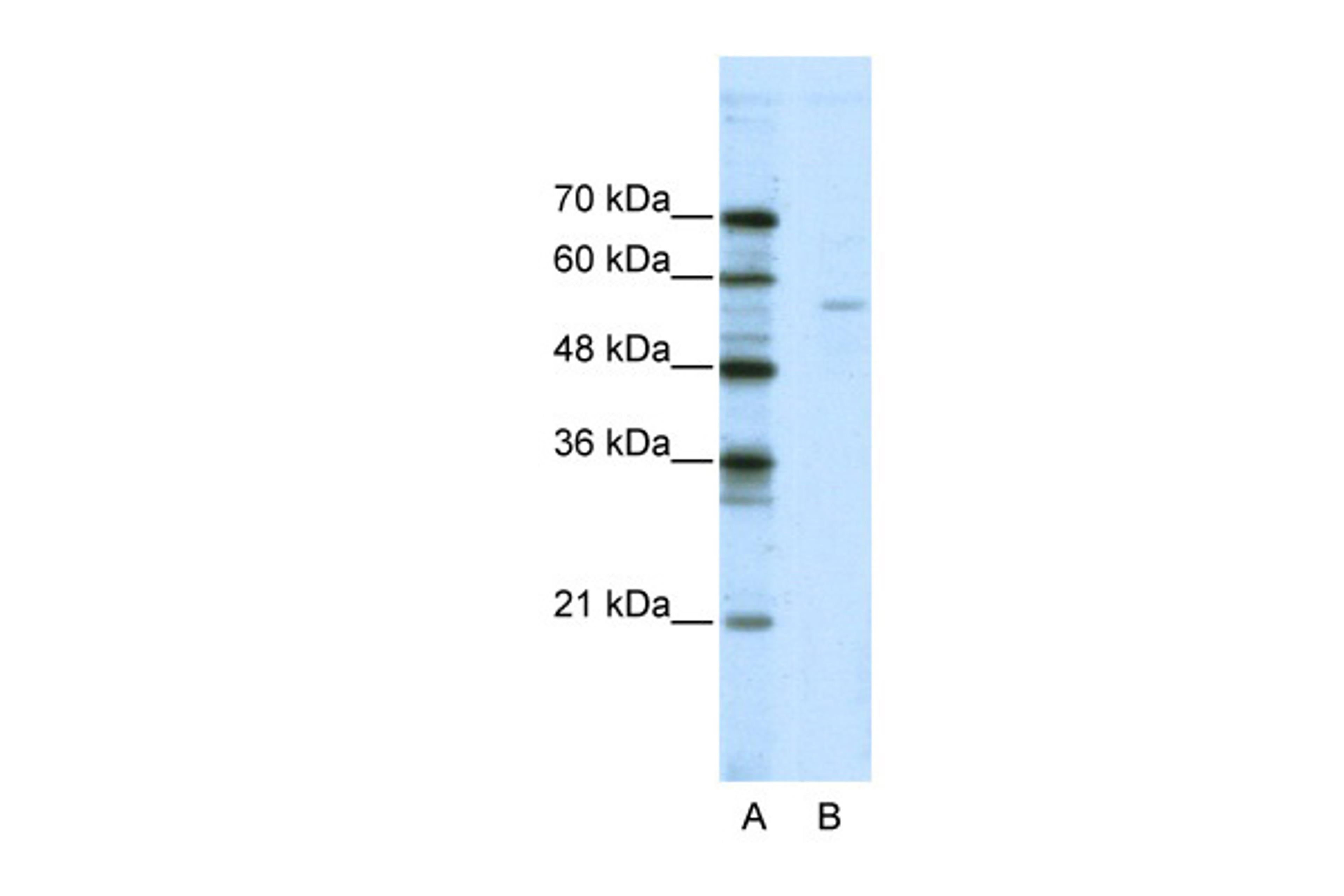 Antibody used in WB on Human Jurkat cells at 2.5 ug/ml.