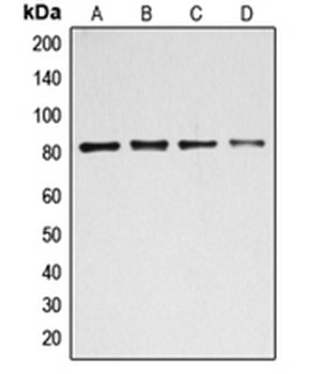 Western blot analysis of HEK293T (Lane 1), MCF7 (Lane 2), K562 (Lane 3), HeLa (Lane 4) whole cell lysates using BACH1 antibody