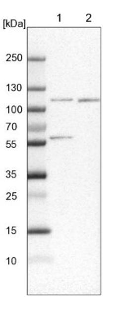 Western Blot: SNX14 Antibody [NBP1-80838] - Lane 1: NIH-3T3 cell lysate (Mouse embryonic fibroblast cells)<br/>Lane 2: NBT-II cell lysate (Rat Wistar bladder tumour cells)