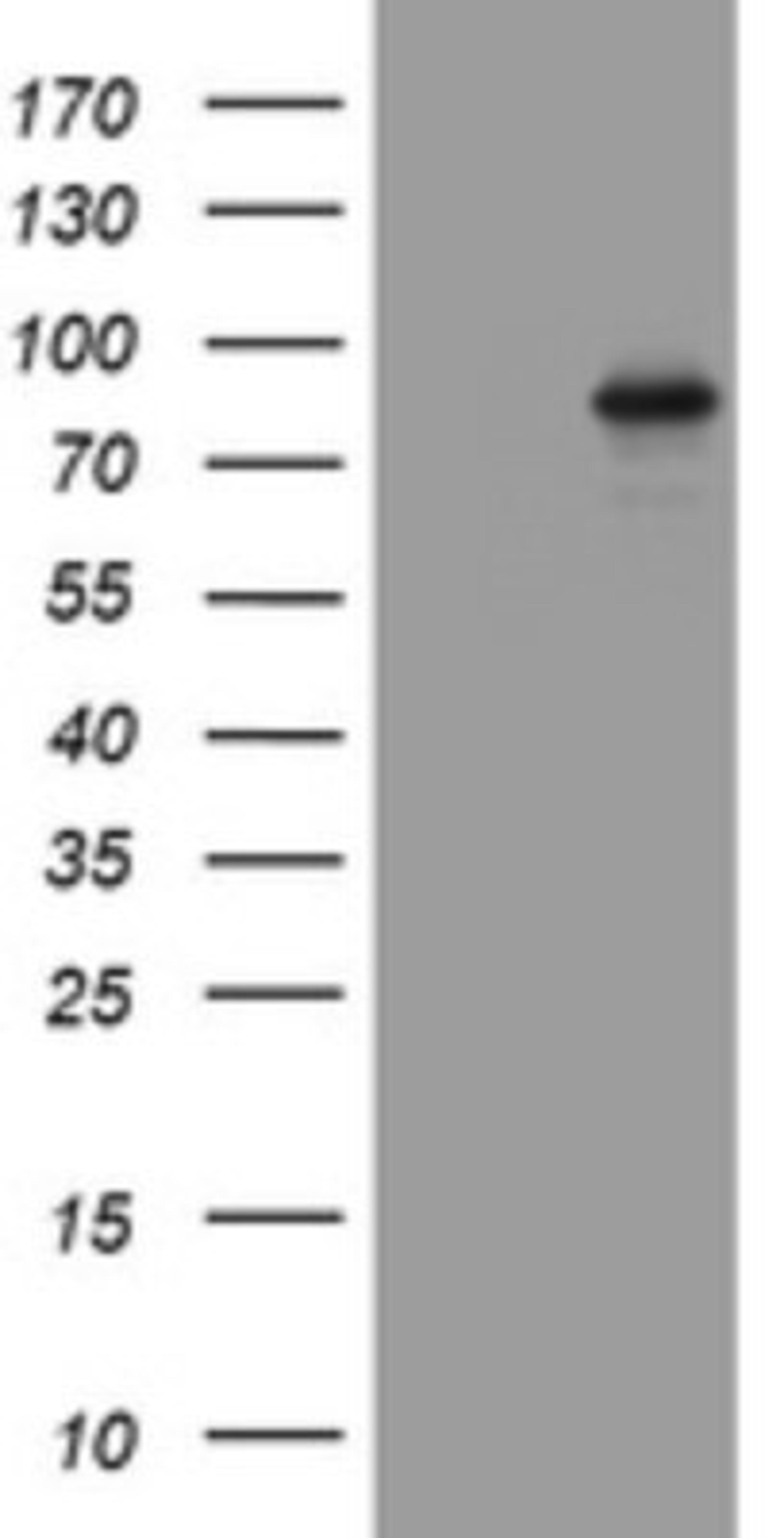 Western Blot: AFAP Antibody (2G9) [NBP2-46498] - Analysis of HEK293T cells were transfected with the pCMV6-ENTRY control (Left lane) or pCMV6-ENTRY AFAP.