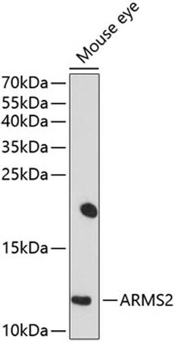 Western blot - ARMS2 antibody (A10161)