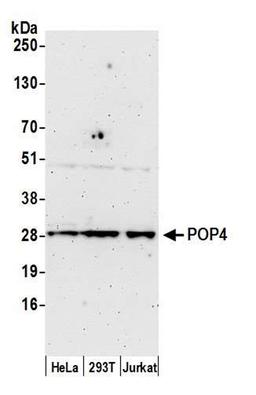 Detection of human POP4 by WB.