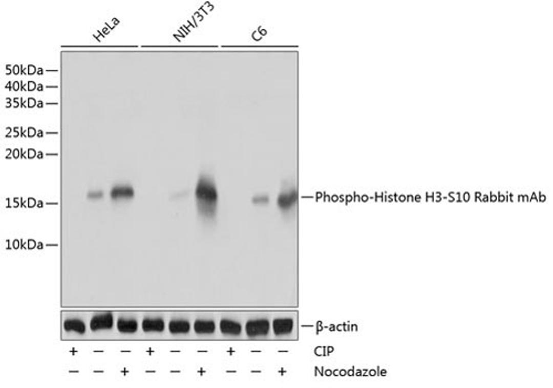 Western blot - Phospho-Histone H3-S10 Rabbit mAb (AP0002)