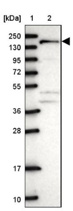 Western Blot: ANKRD50 Antibody [NBP1-93594] - Lane 1: Marker [kDa] 250, 130, 95, 72, 55, 36, 28, 17, 10<br/>Lane 2: Human cell line RT-4