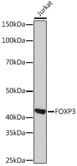 Western blot - FOXP3 Rabbit mAb (A4953)