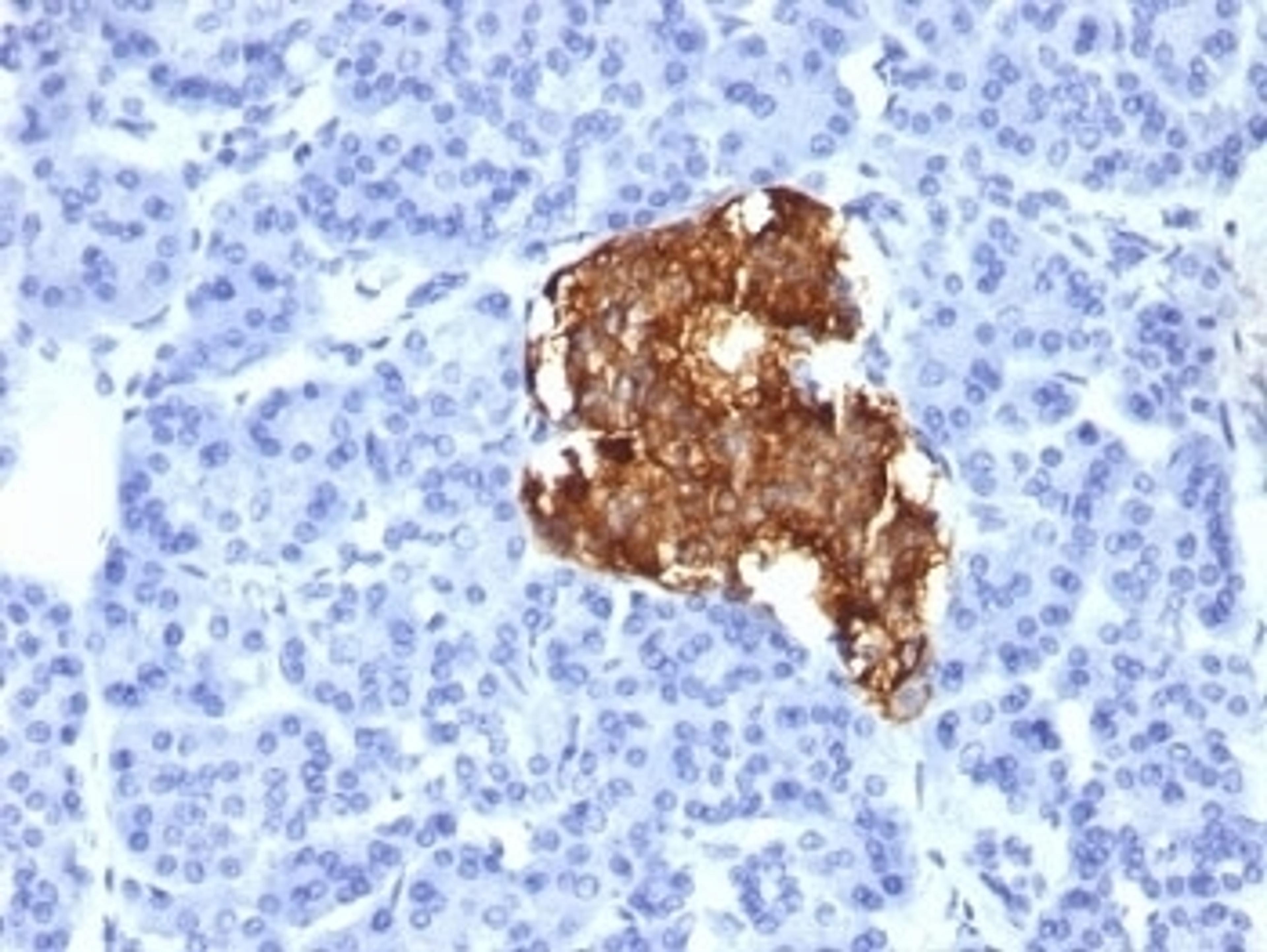 Formalin-fixed, paraffin-embedded human pancreas stained with Insulin antibody (IRDN/805).