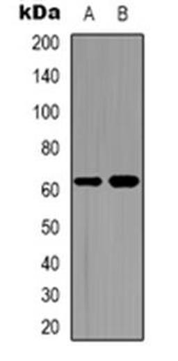 Western blot analysis of CDC6 expression in Hela (Lane 1), Jurkat (Lane 2) whole cell lysates using CDC6 antibody