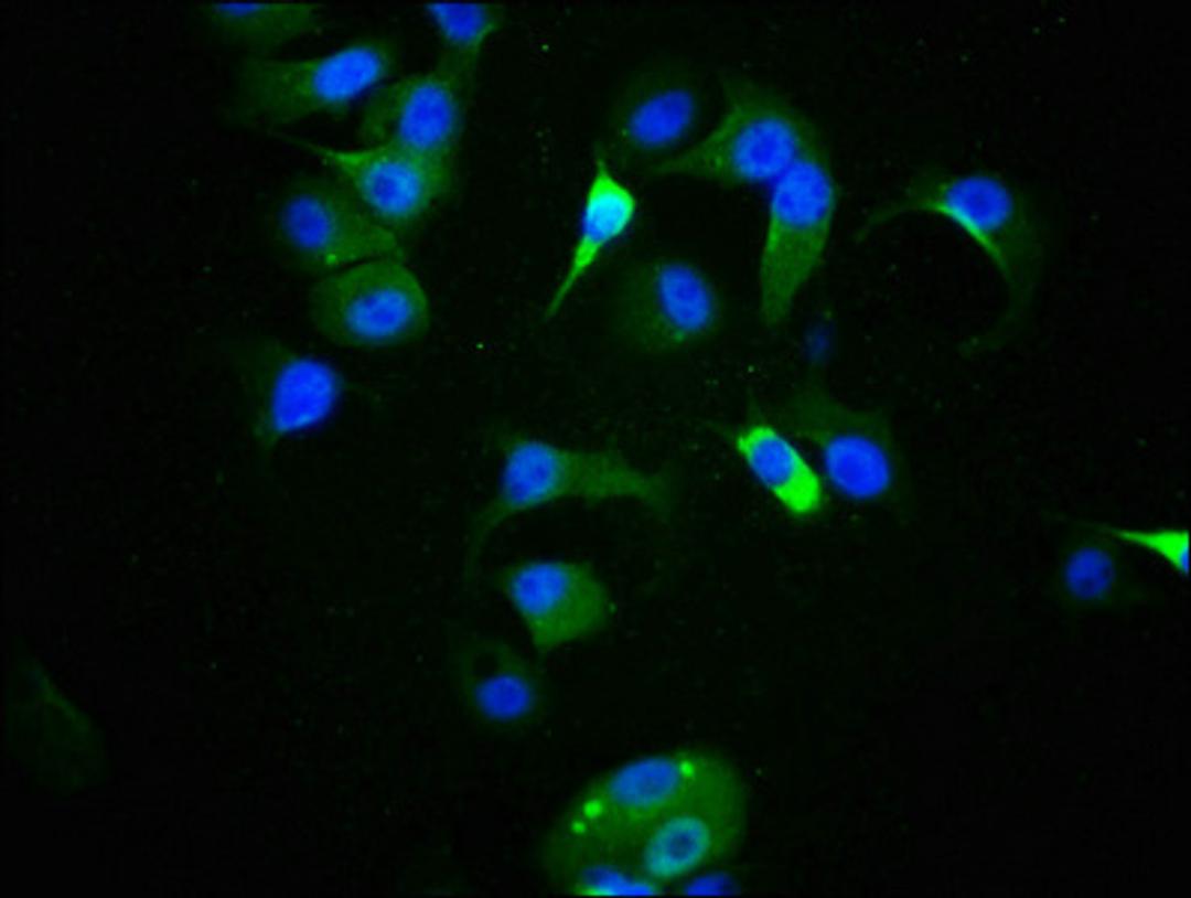 Immunofluorescence staining of MCF-7 cells with CSB-RA024077A09phHU at 1:100,counter-stained with DAPI. The cells were fixed in 4% formaldehyde, permeabilized using 0.2% Triton X-100 and blocked in 10% normal Goat Serum. The cells were then incubated with the antibody overnight at 4℃. The secondary antibody was Alexa Fluor 488-congugated AffiniPure Goat Anti-Rabbit IgG (H+L).