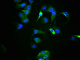 Immunofluorescence staining of MCF-7 cells with CSB-RA024077A09phHU at 1:100,counter-stained with DAPI. The cells were fixed in 4% formaldehyde, permeabilized using 0.2% Triton X-100 and blocked in 10% normal Goat Serum. The cells were then incubated with the antibody overnight at 4℃. The secondary antibody was Alexa Fluor 488-congugated AffiniPure Goat Anti-Rabbit IgG (H+L).