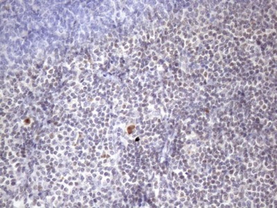 Immunohistochemistry: ZC3H8 Antibody (4H5) [NBP2-46397] - Analysis of Human tonsil tissue. (Heat-induced epitope retrieval by 1mM EDTA in 10mM Tris buffer (pH8.5) at 120C for 3 min)