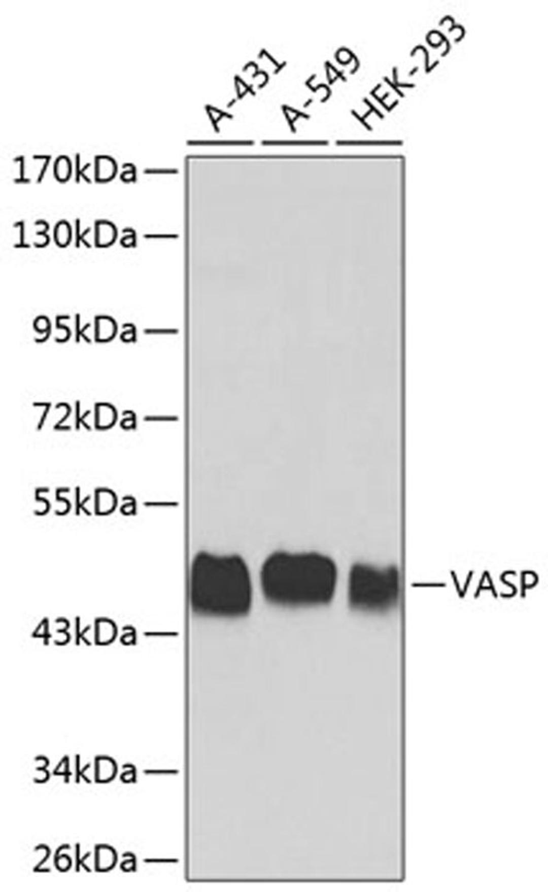 Western blot - VASP antibody (A0166)