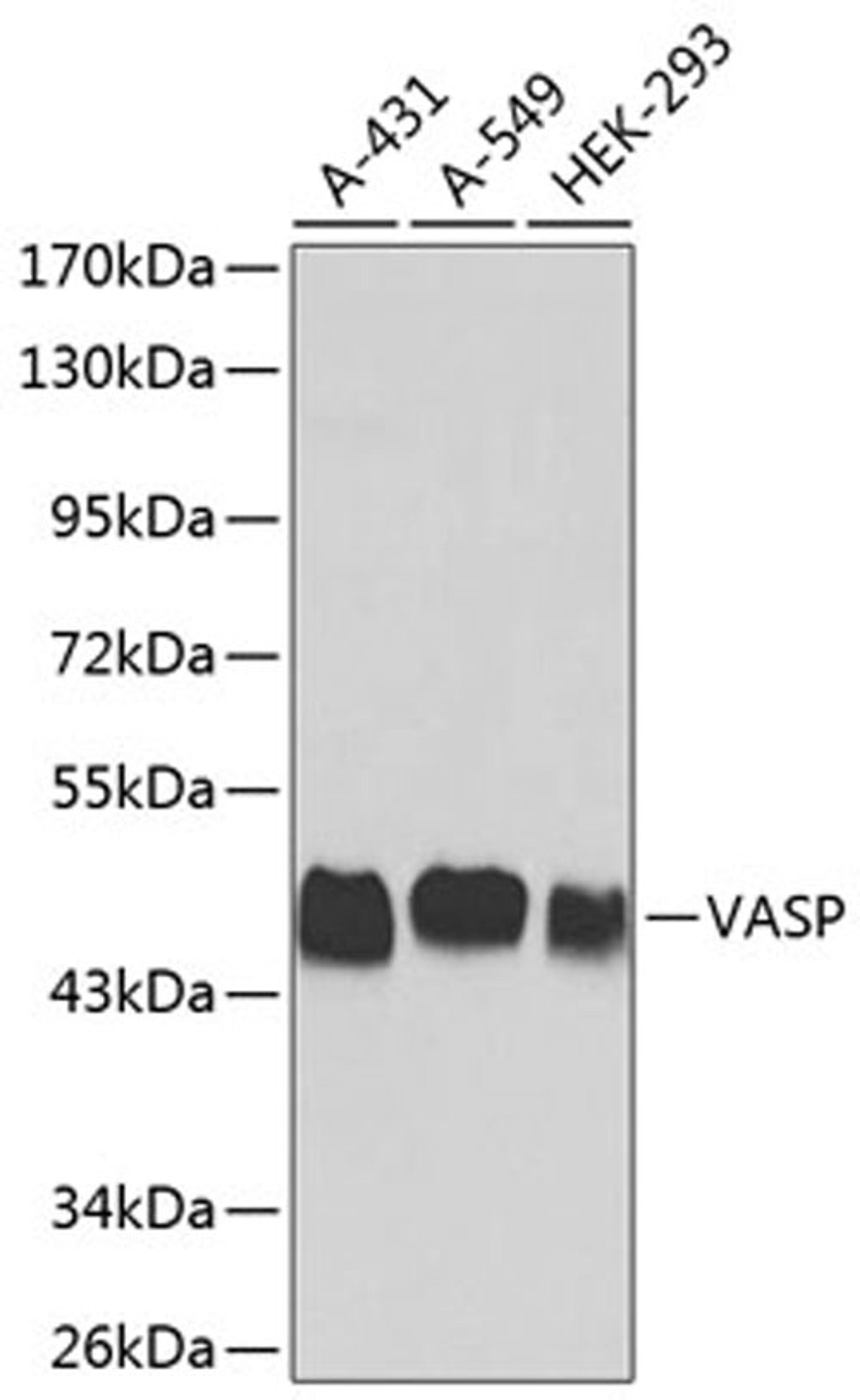 Western blot - VASP antibody (A0166)