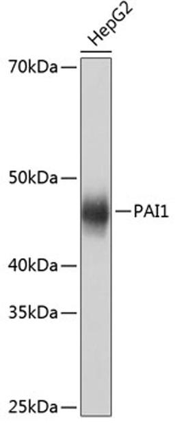 Western blot - PAI1 antibody (A19096)