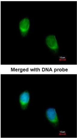 Immunocytochemistry/Immunofluorescence: Wnt-11 Antibody [NBP1-31406] -  Analysis of HeLa, using NBP1-31406 at 1:200 dilution.