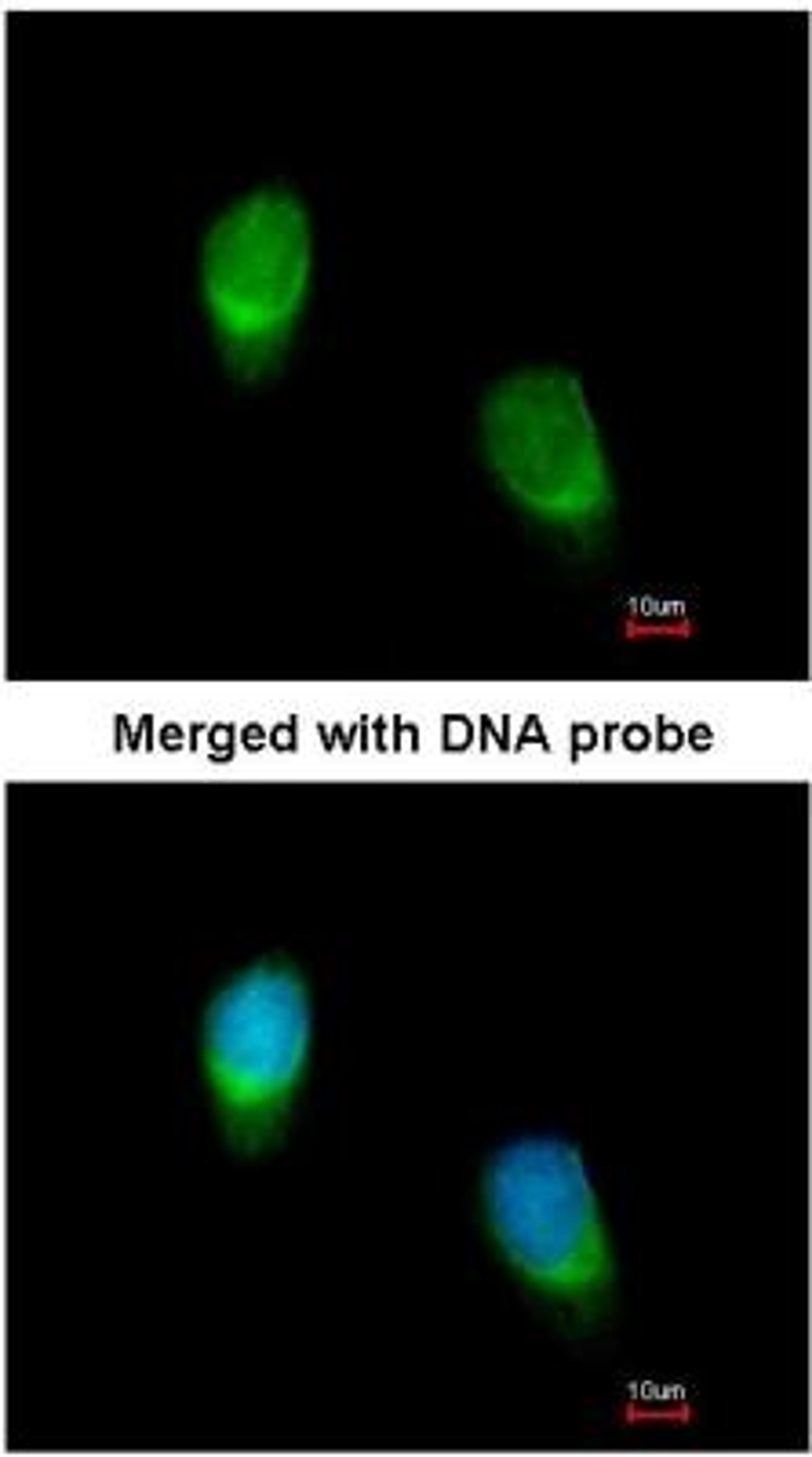 Immunocytochemistry/Immunofluorescence: Wnt-11 Antibody [NBP1-31406] -  Analysis of HeLa, using NBP1-31406 at 1:200 dilution.