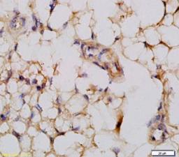 Immunohistochemical staining of rat thymus gland tissue using JNK1-2-3 (phospho-Thr183-185) antibody.