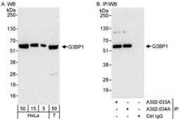 Detection of human G3BP1 by western blot and immunoprecipitation.