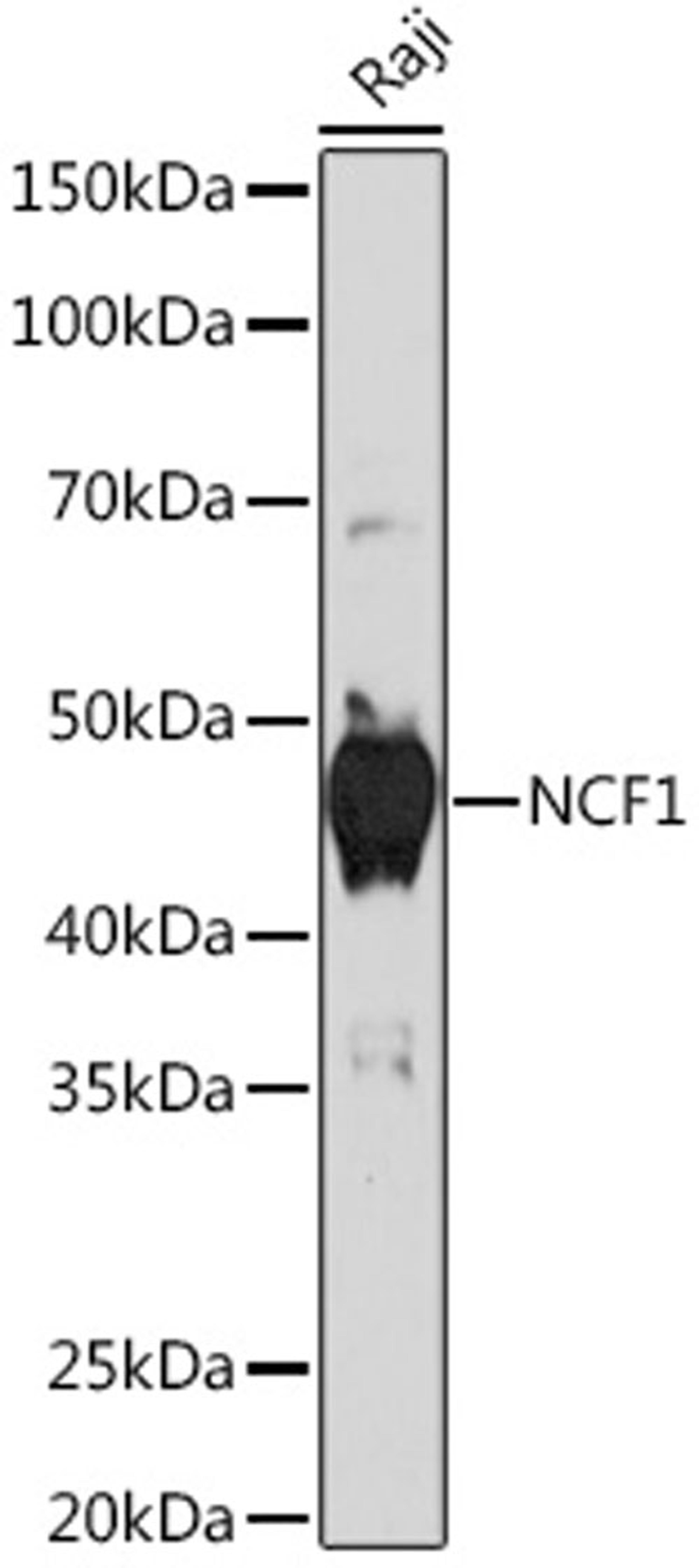 Western blot - NCF1 Rabbit mAb (A5143)