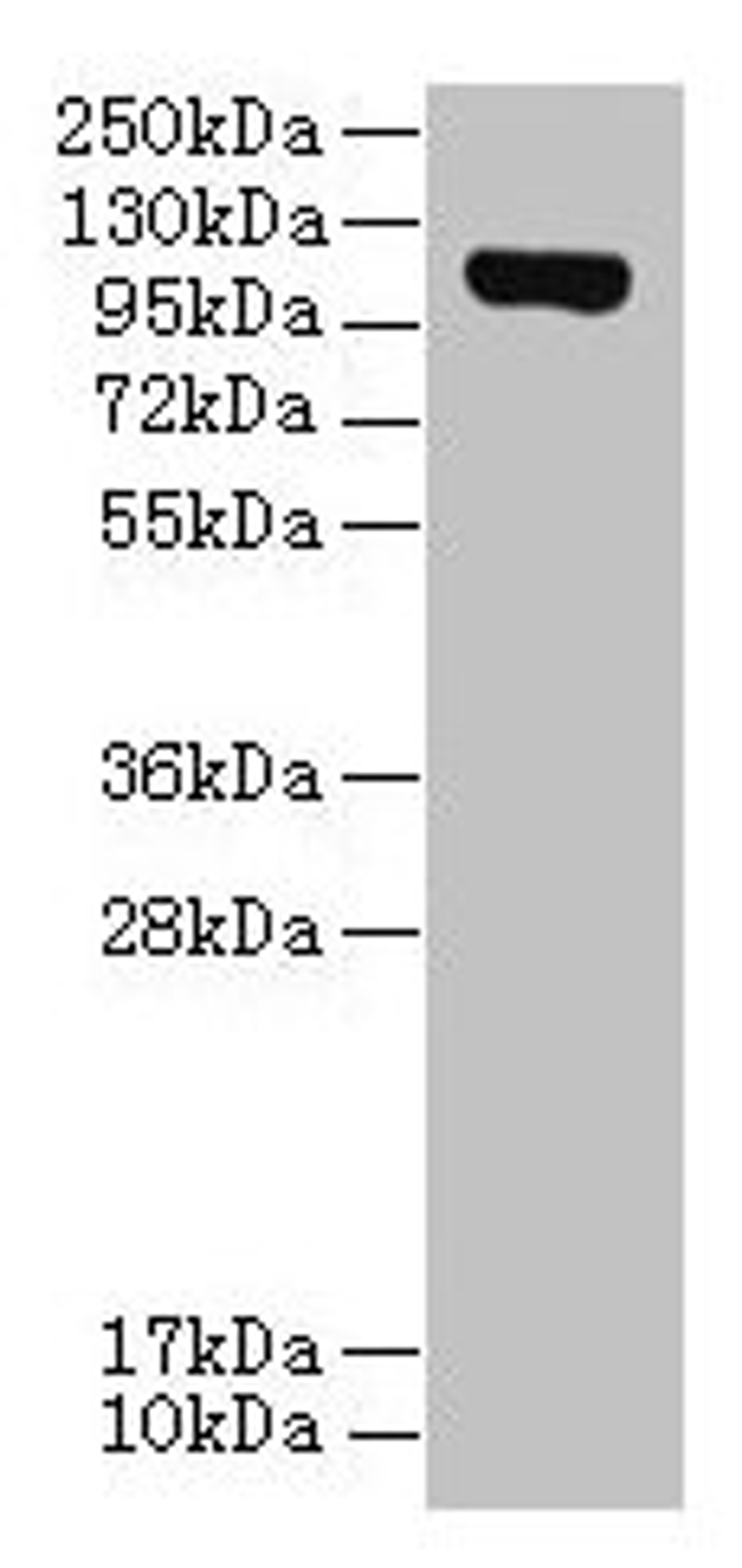 Western blot. All lanes: DENND2C antibody at 8µg/ml + A431 whole cell lysate. Secondary. Goat polyclonal to rabbit IgG at 1/10000 dilution. Predicted band size: 107, 95, 101 kDa. Observed band size: 107 kDa