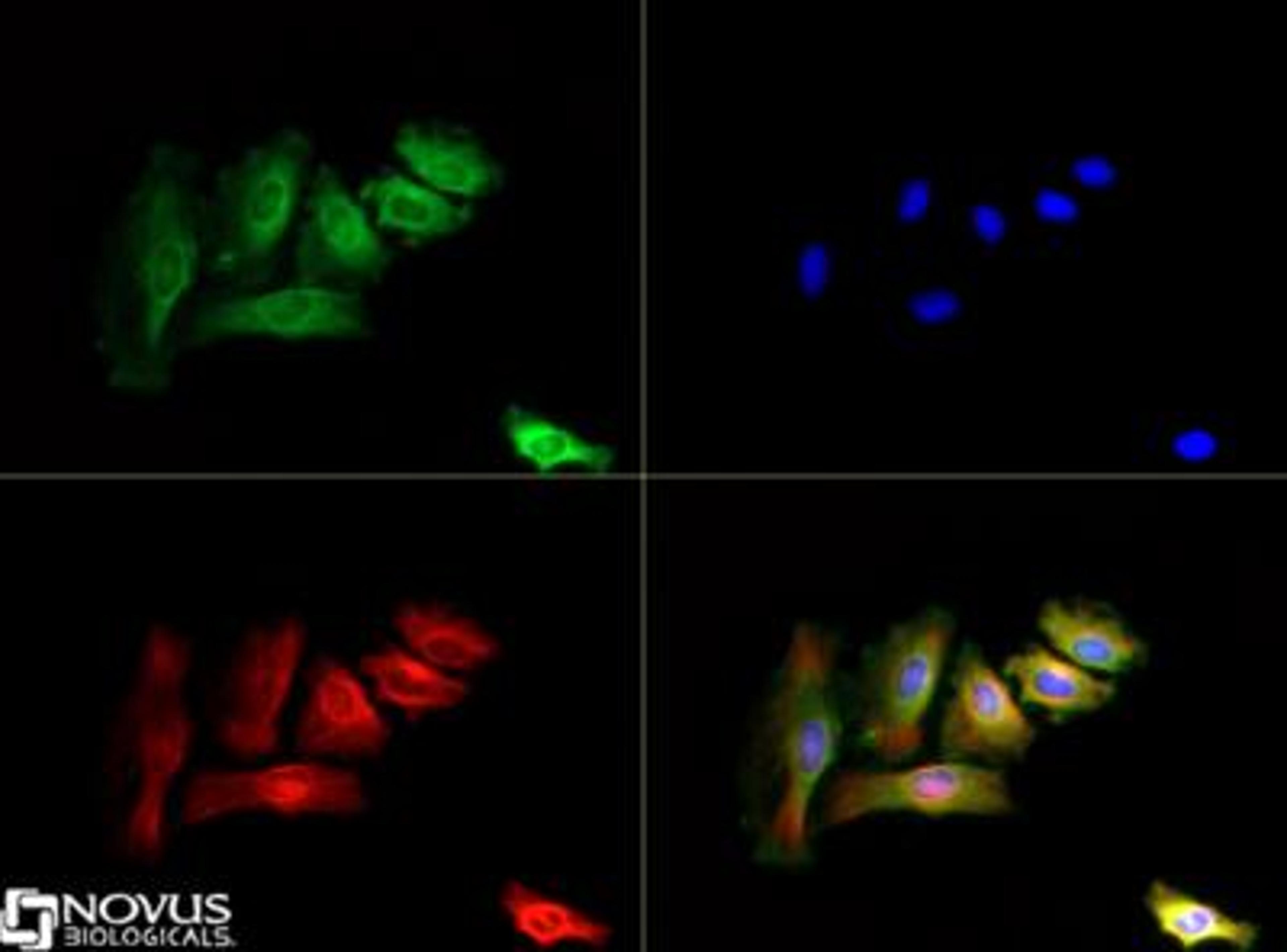 Immunocytochemistry/Immunofluorescence: 5-Lipoxygenase Antibody [NB110-58748] - 5-Lipoxygenase antibody was tested in Hela cells with DyLight 488 (green). Nuclei and alpha-tubulin were counterstained with DAPI (blue) and Dylight 550 (red).