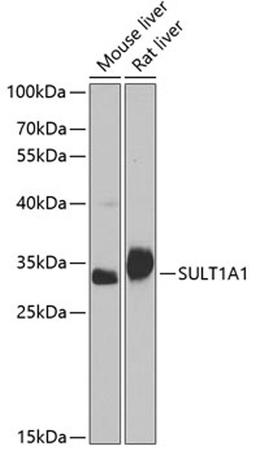 Western blot - SULT1A1 antibody (A1599)