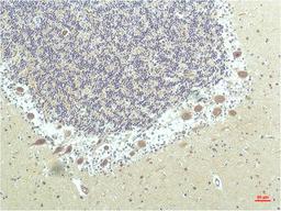 Immunohistochemical analysis of paraffin-embedded Human Brain Tissue using PPAR Delta Mouse mAb diluted at 1:200.