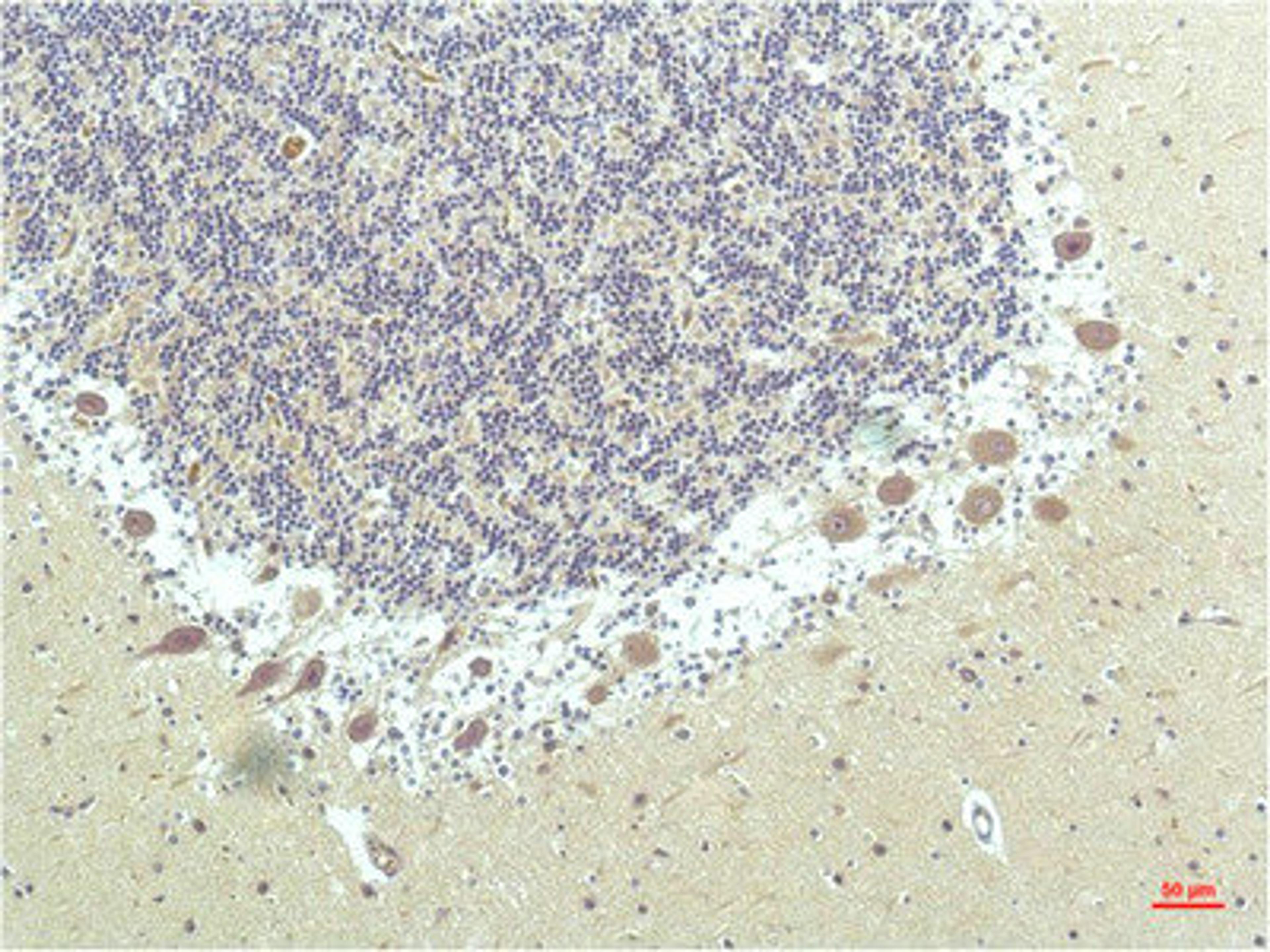 Immunohistochemical analysis of paraffin-embedded Human Brain Tissue using PPAR Delta Mouse mAb diluted at 1:200.