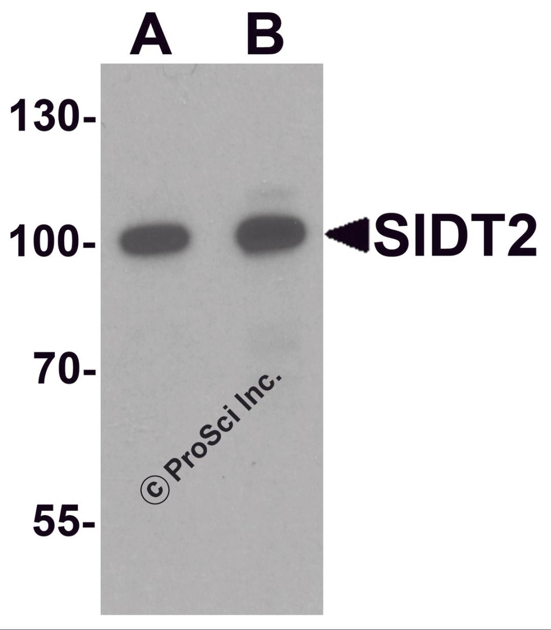 Western blot analysis of SIDT2 in mouse brain tissue lysate with SIDT2 antibody at (A) 0.5 and (B) 1 &#956;g/mL.