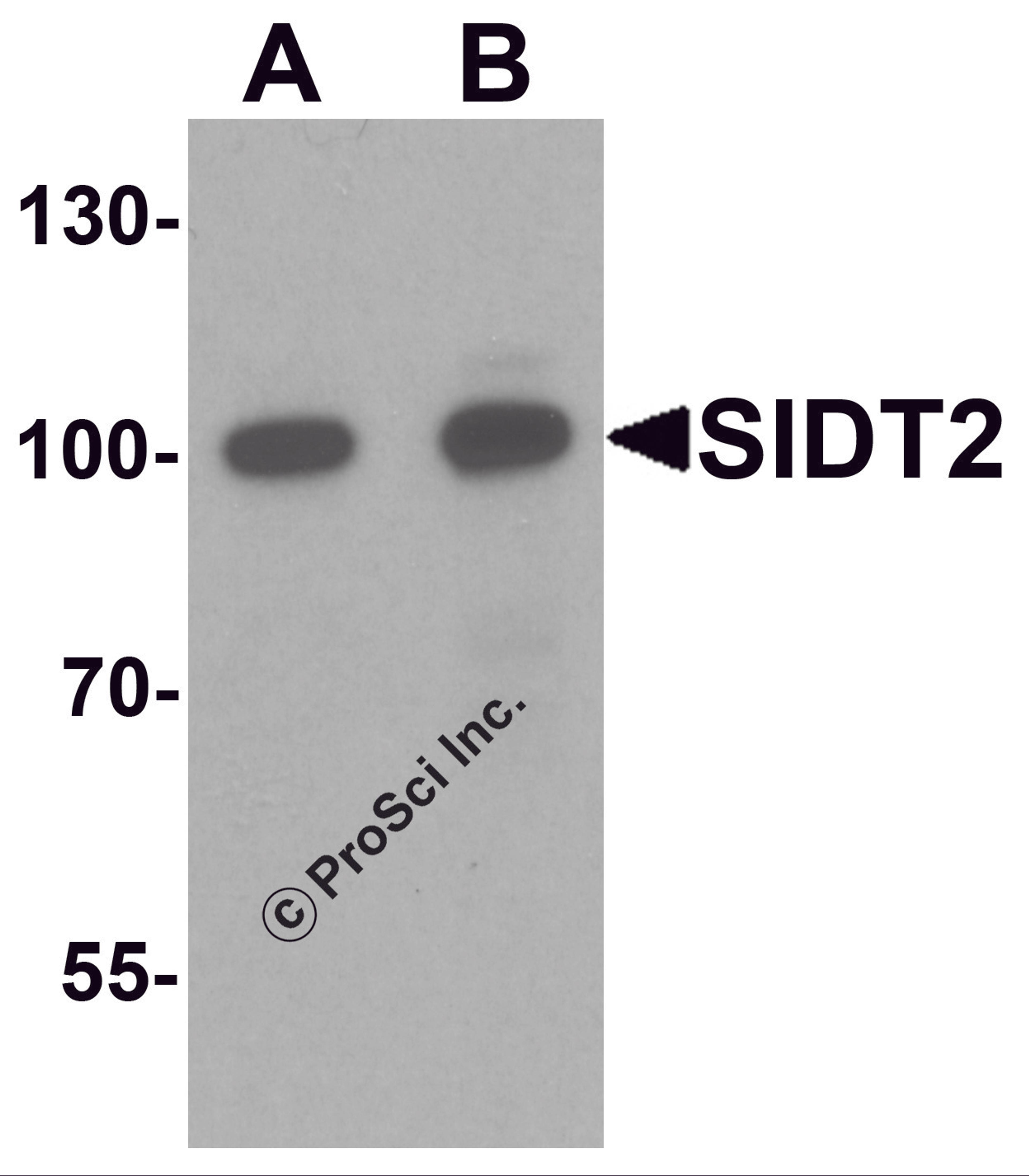 Western blot analysis of SIDT2 in mouse brain tissue lysate with SIDT2 antibody at (A) 0.5 and (B) 1 &#956;g/mL.