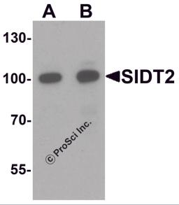 Western blot analysis of SIDT2 in mouse brain tissue lysate with SIDT2 antibody at (A) 0.5 and (B) 1 μg/mL.