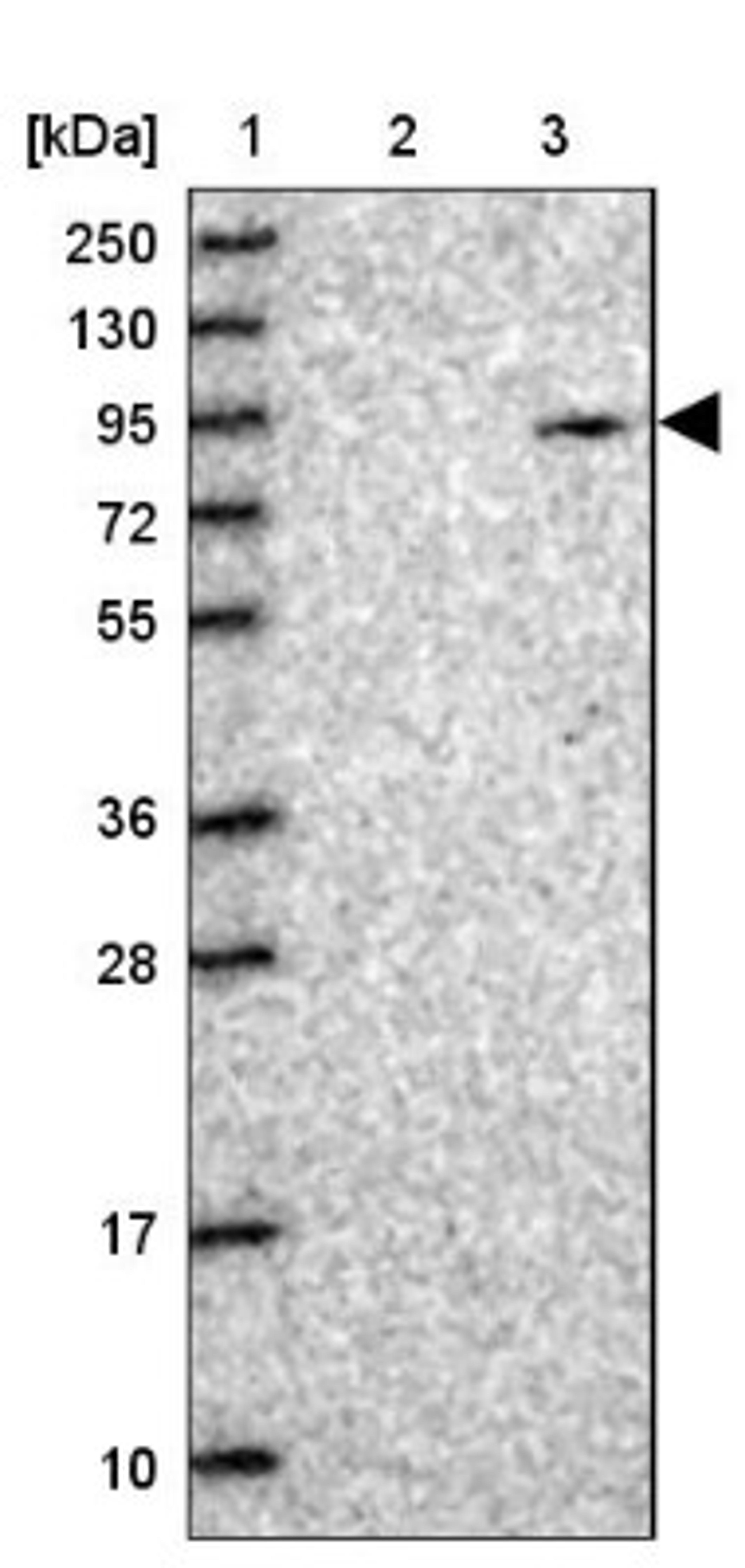 Western Blot: MYO16 Antibody [NBP1-93617] - Lane 1: Marker [kDa] 250, 130, 95, 72, 55, 36, 28, 17, 10<br/>Lane 2: Human cell line RT-4<br/>Lane 3: Human cell line U-251MG sp