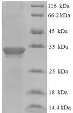 (Tris-Glycine gel) Discontinuous SDS-PAGE (reduced) with 5% enrichment gel and 15% separation gel.