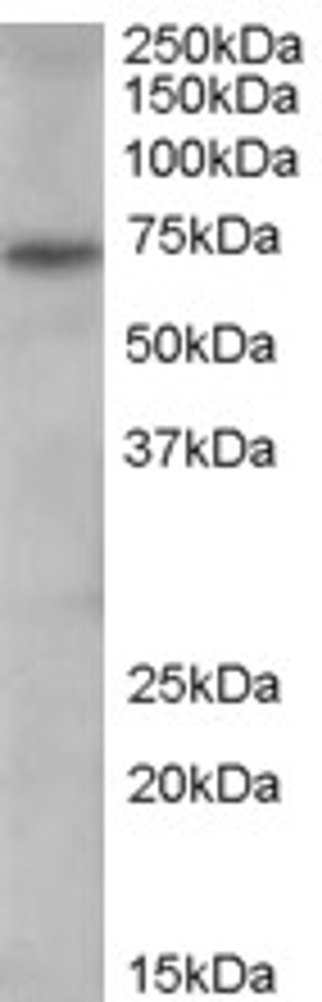 46-126 (0.3ug/ml) staining of Human Spleen lysate (35ug protein in RIPA buffer). Primary incubation was 1 hour. Detected by chemiluminescence.