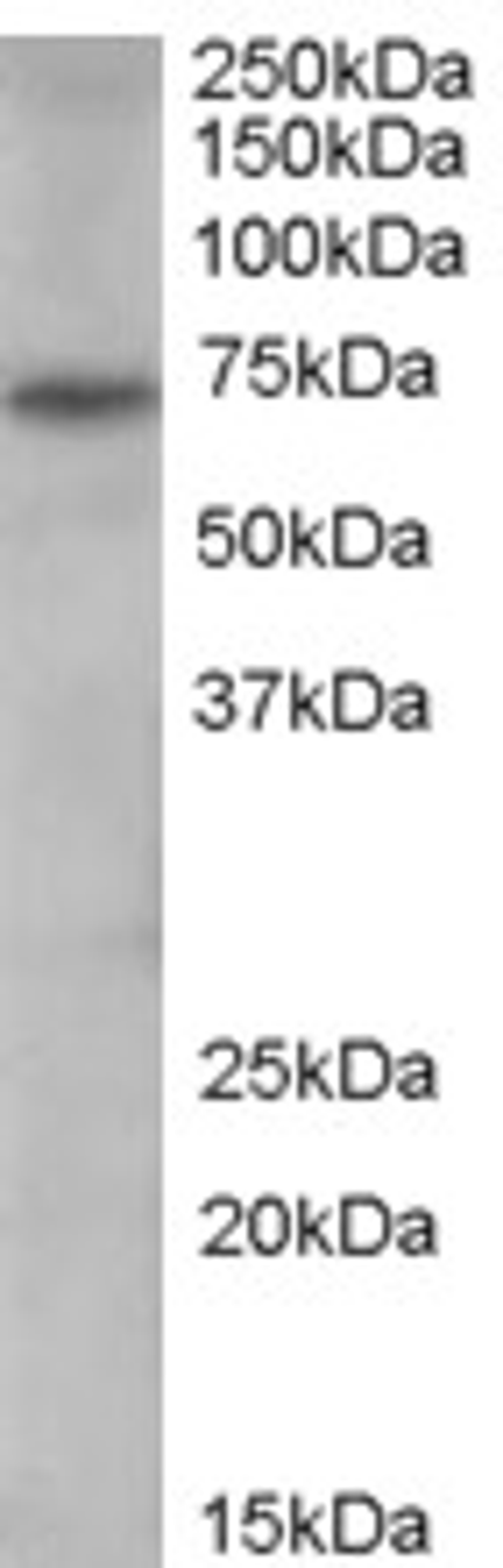 46-126 (0.3ug/ml) staining of Human Spleen lysate (35ug protein in RIPA buffer). Primary incubation was 1 hour. Detected by chemiluminescence.