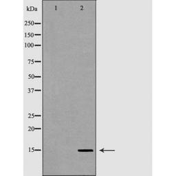 Western blot analysis of HeLa cell line and H3 protein expressed in E.coli using Histone H3R17me2a antibody