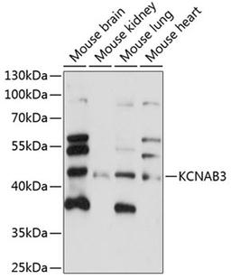 Western blot - KCNAB3 antibody (A14821)