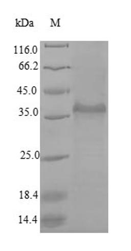 (Tris-Glycine gel) Discontinuous SDS-PAGE (reduced) with 5% enrichment gel and 15% separation gel.