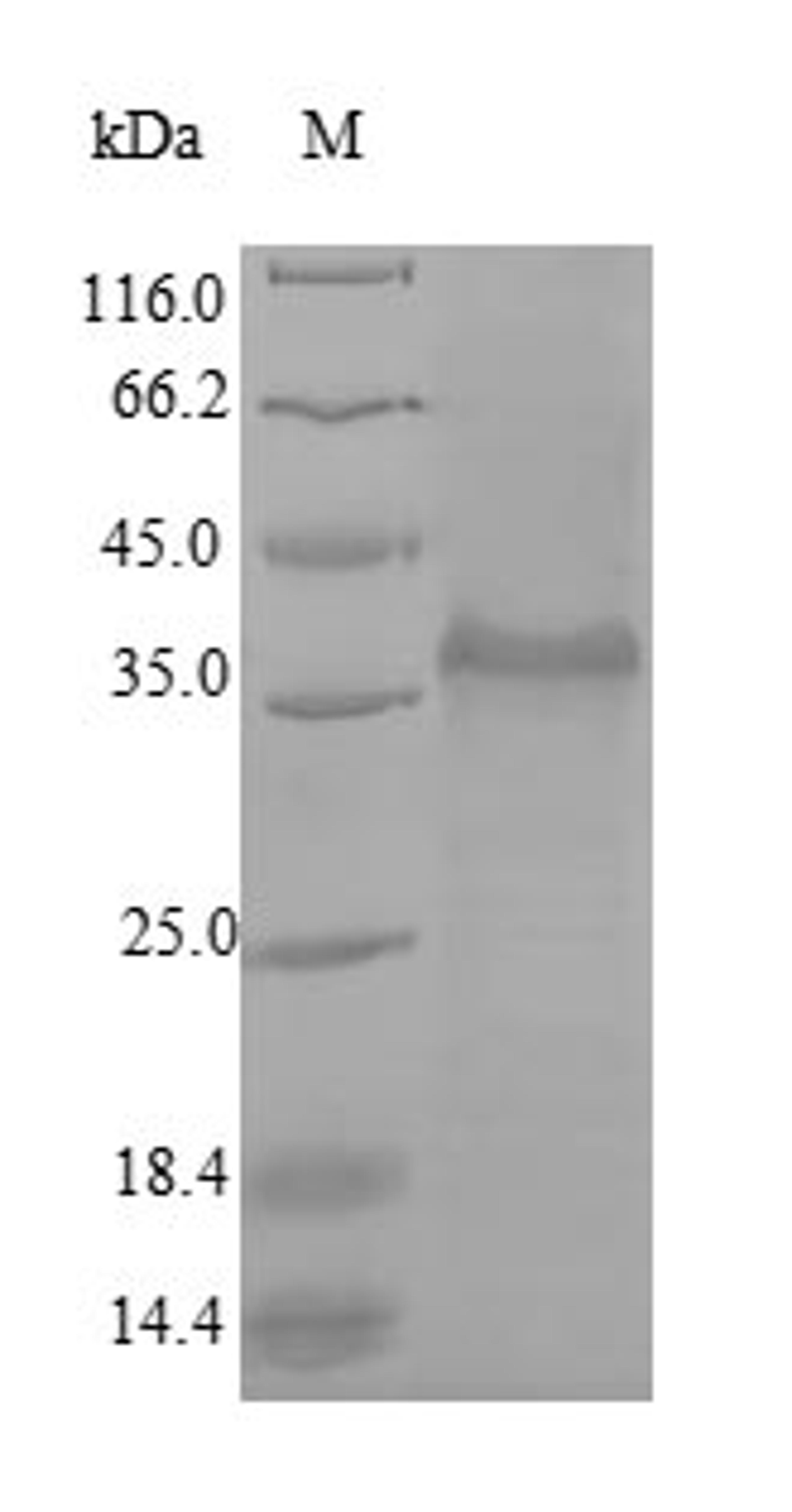 (Tris-Glycine gel) Discontinuous SDS-PAGE (reduced) with 5% enrichment gel and 15% separation gel.
