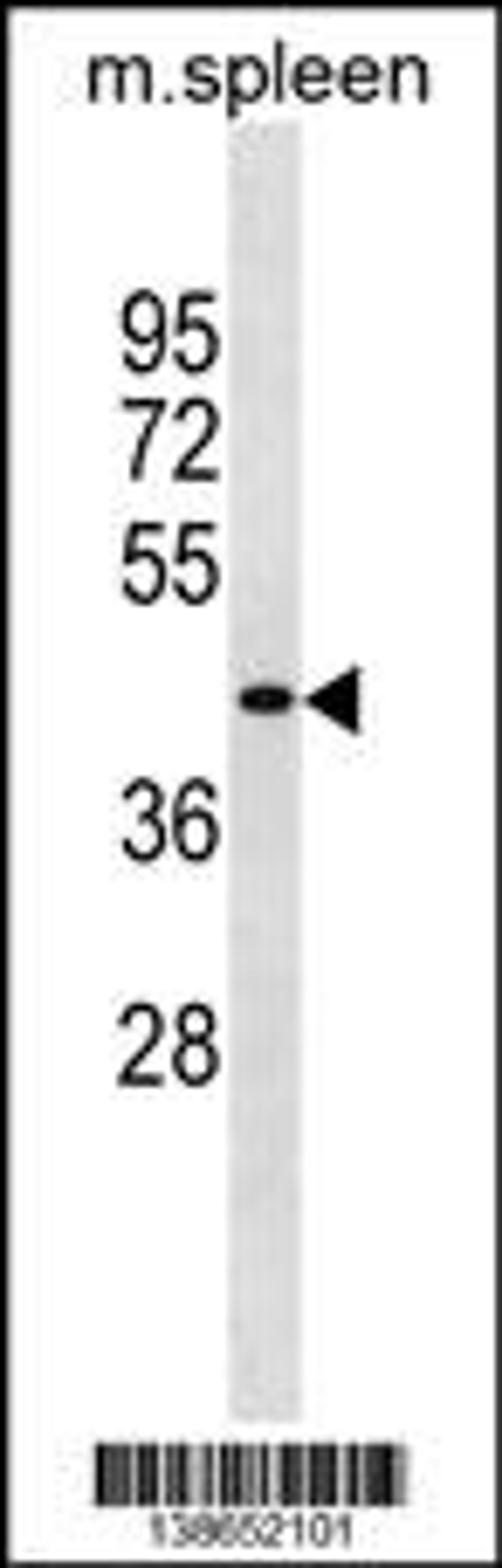 Western blot analysis in mouse spleen tissue lysates (35ug/lane).This demonstrates the detected the Mouse Slc10a2 protein (arrow).