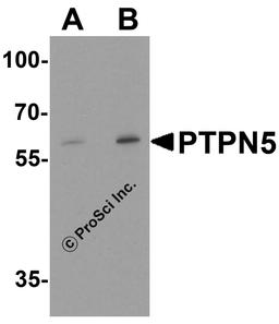 Western blot analysis of PTPN5 in Jurkat cell lysate with PTPN5 antibody at (A) 1 and (B) 2 μg/ml.
