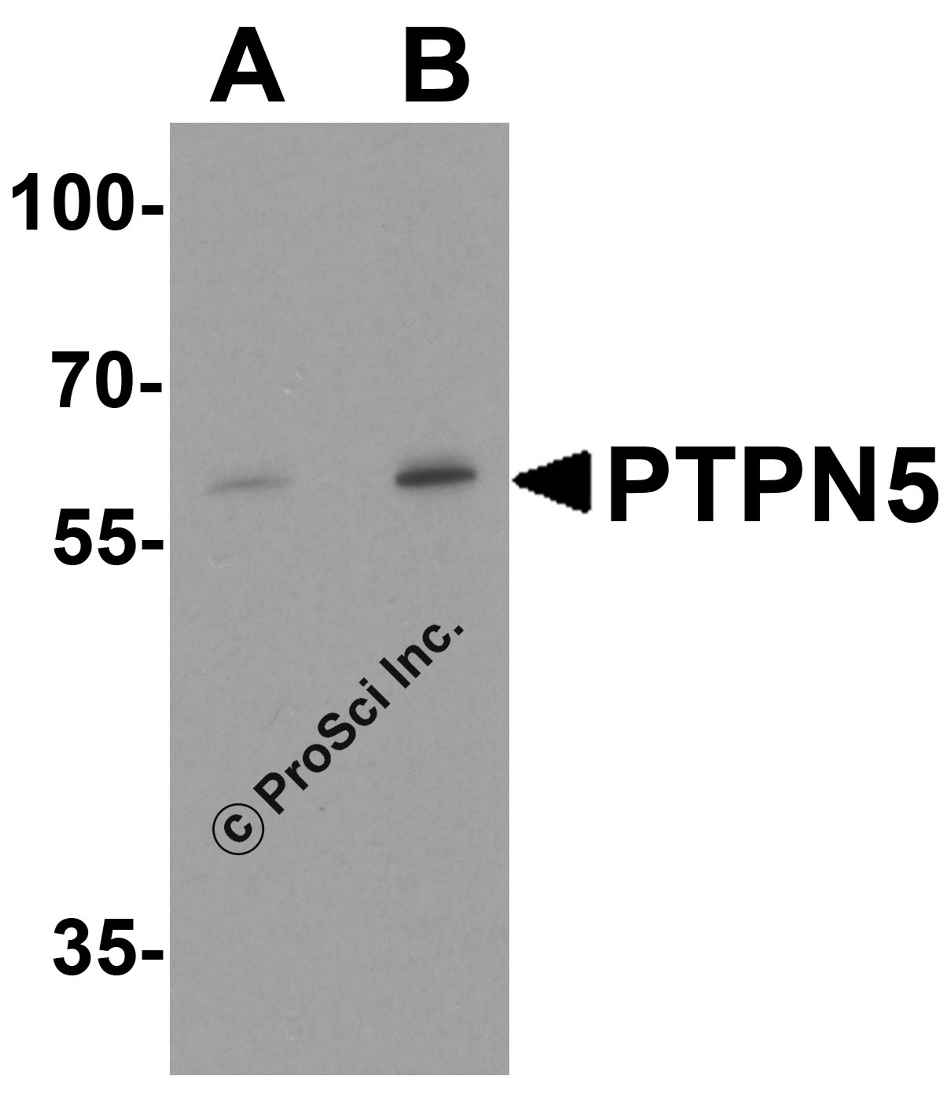 Western blot analysis of PTPN5 in Jurkat cell lysate with PTPN5 antibody at (A) 1 and (B) 2 μg/ml.