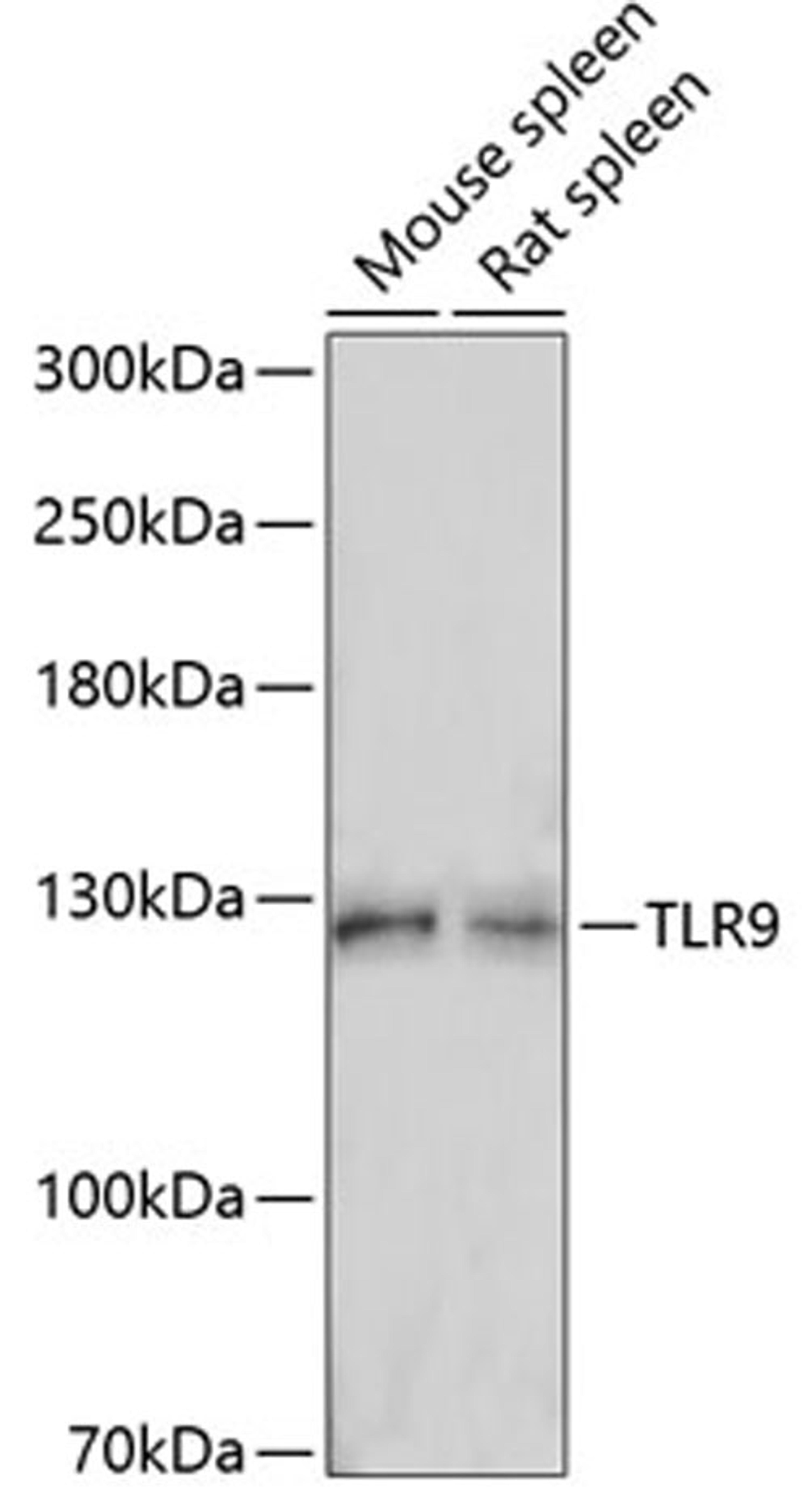 Western blot - TLR9 antibody (A14642)